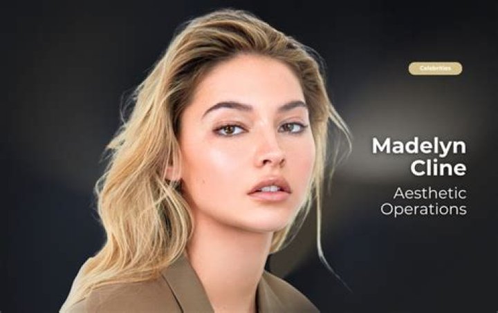 Did Madelyn Cline Enhance Her Pout?