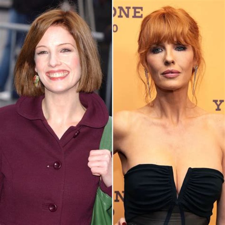 Kelly Reilly's Lips, Teeth, And Plastic Surgery