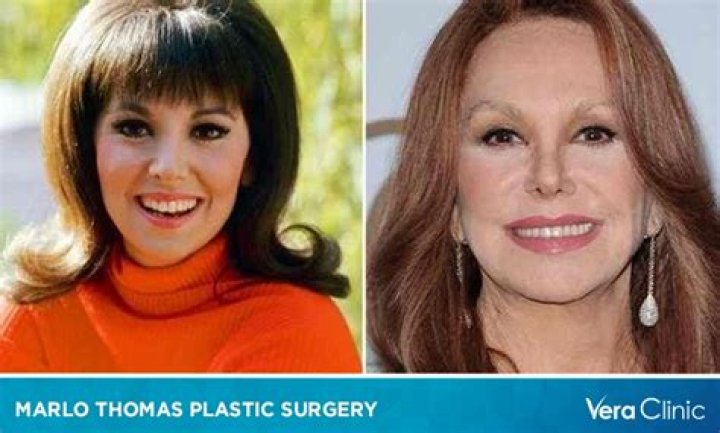 Uncovering The Truths Of Marlo Thomas Plastic: Surprising Revelations