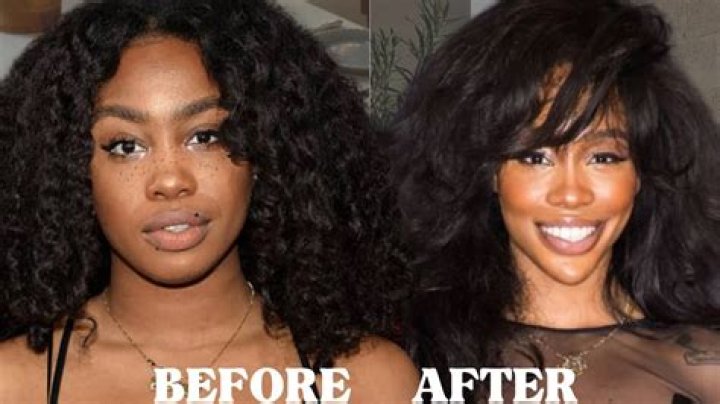Unveiling The Evolution Of SZA: A Pre-Surgery Exploration